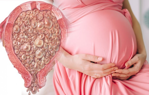 Was ist Traubenschwangerschaft, Traubenschwangerschaftssymptome