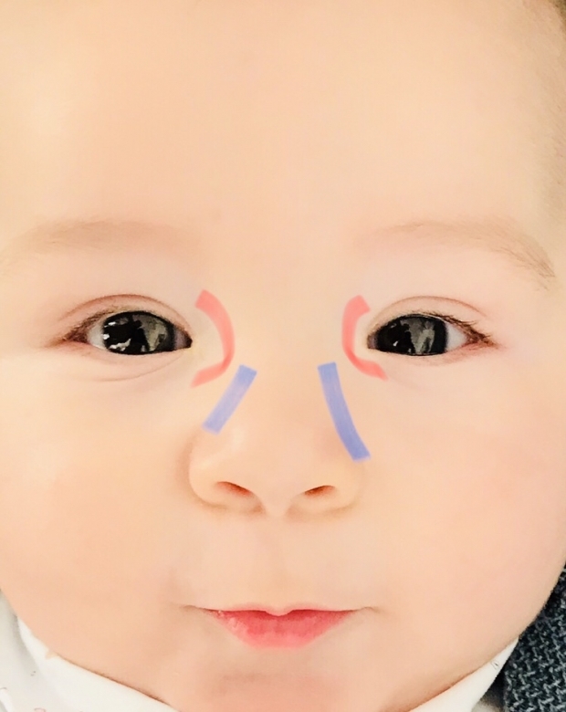 Augengratmassage bei Babys
