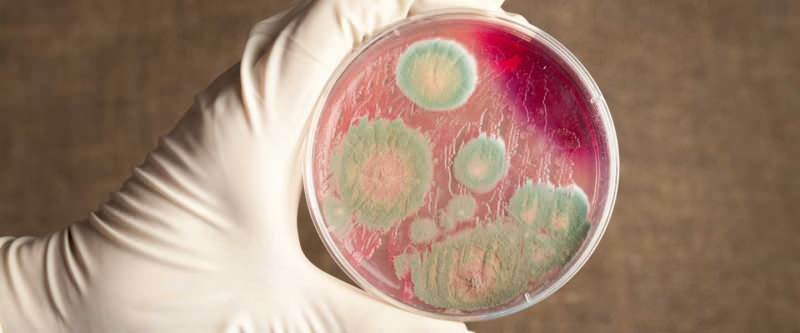 Was ist Anthrax und wie wird Anthrax übertragen? Experten warnen