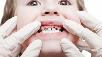 Lassen Sie die Zahnpflege Ihres Kindes während des Semesters erledigen!