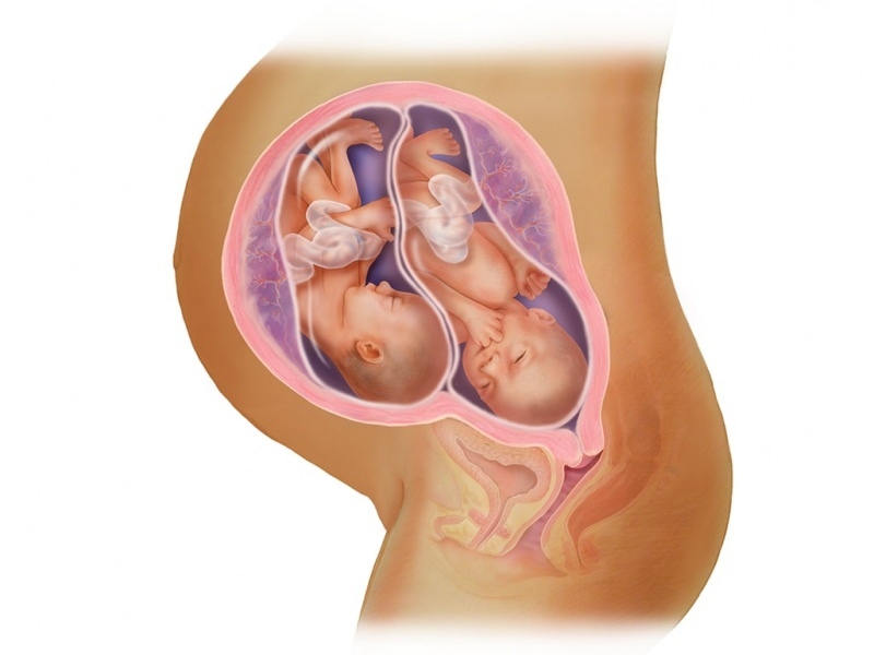Zwillingsschwangerschaft bei IVF! Was ist Embryotransfer?