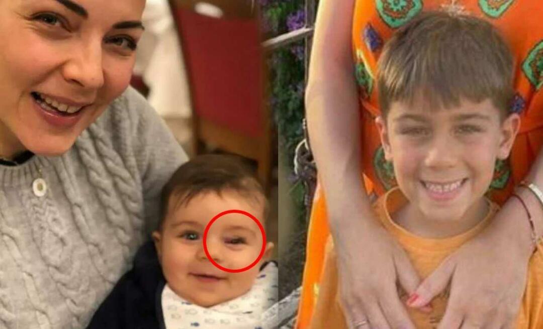 Burcu Kara gab die Krankheit ihres Sohnes bekannt! Die Schwellung in Ihrem Auge ist ein Zeichen für einen Tumor ...