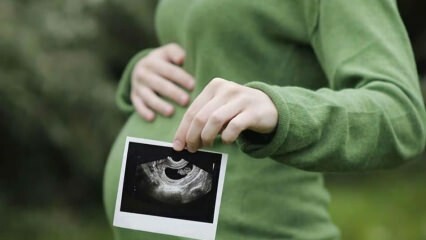 Wann ist das Geschlecht des Babys frühestens und endgültig? Wer bestimmt das Geschlecht?