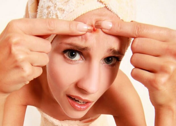 Verursacht Akne Kopfschmerzen? Was tun gegen schmerzhafte Pickel? Schmerzen durch Akne ...