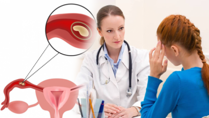 Was ist eine Eileiterschwangerschaft (Eileiterschwangerschaft), warum? Was sind die Anzeichen einer Eileiterschwangerschaft?