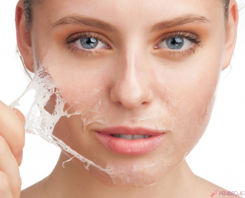 Was ist gut für Hautpeeling und wie ist Hautpeeling? Hausmittel gegen Hautpeeling
