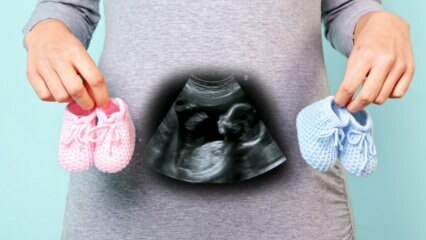 Wird das Geschlecht des Babys im ersten Schwangerschaftstrimester bestimmt?