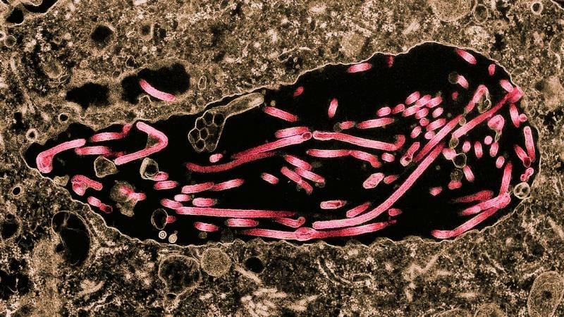 Bild der Ausbreitung von Ebolan auf Zellen