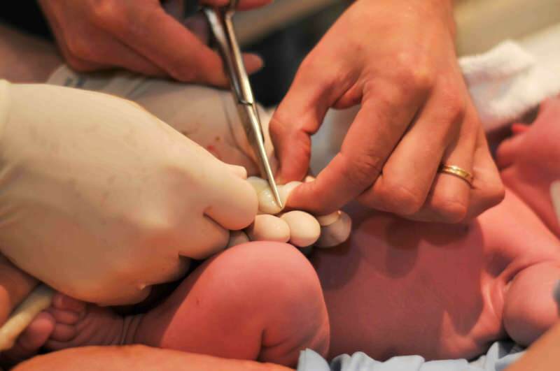Wann sollte die Nabelschnur bei Babys durchtrennt werden?