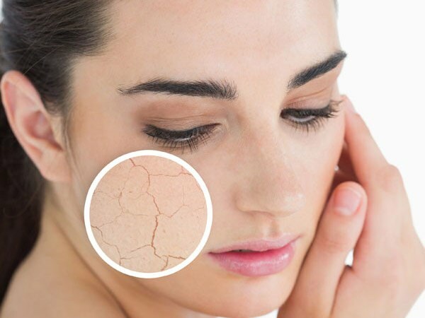 Tipps zur trockenen Hautpflege