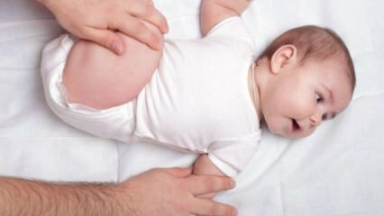 Wie versteht man eine Hüftluxation bei Säuglingen?