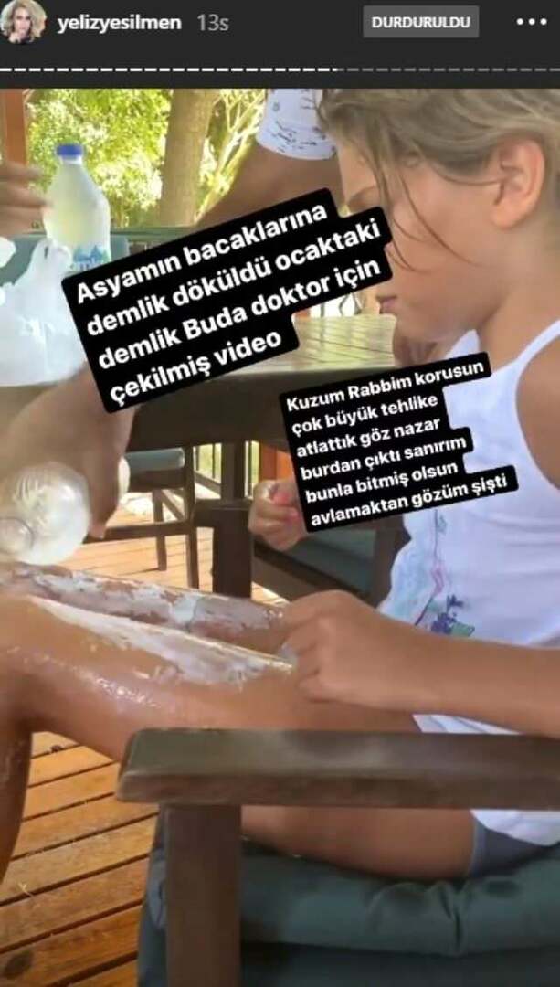 Auf die Beine von Yeliz Yeşilmens Tochter wurde kochendes Wasser gegossen