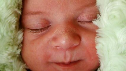 Warum erscheinen weiße Punkte bei Babys?