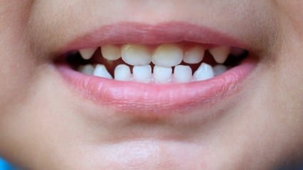 Wie kann man Kindern Zahnpflege beibringen?