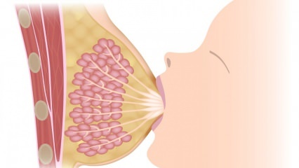 Was ist Mastitis (Brustentzündung)? Mastitis Symptome und Behandlung während des Stillens