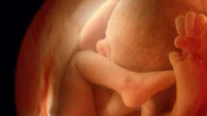 Das Geschlecht des Babys wird im Ultraschall nicht angezeigt! Wie sehen Jungen und Mädchen im Ultraschall aus?