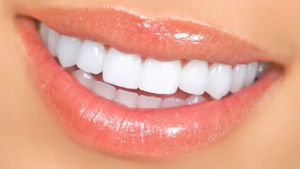 Natürliche Zahnaufhellungsmethoden