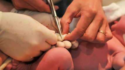 Wann wird die Nabelschnur bei Babys durchtrennt? Vorteile des späten Durchtrennens der Nabelschnur