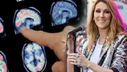 Was ist das Stiff-Person-Syndrom? Celine Dion