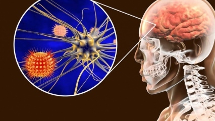 Was ist Meningitis und was sind die Symptome? Gibt es eine Behandlung für Meningitis?