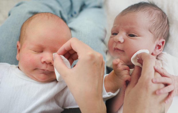 Wie ist Augengrat bei Babys?