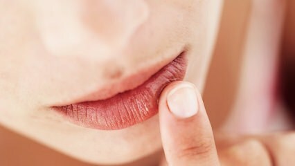 Wie soll die Lippenpflege während der Schwangerschaft sein?