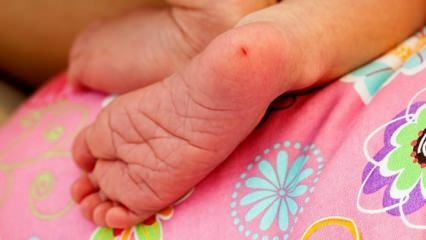 Warum wird Fersenblut bei Säuglingen entnommen? Anforderungen für die Fersenblutuntersuchung bei Säuglingen
