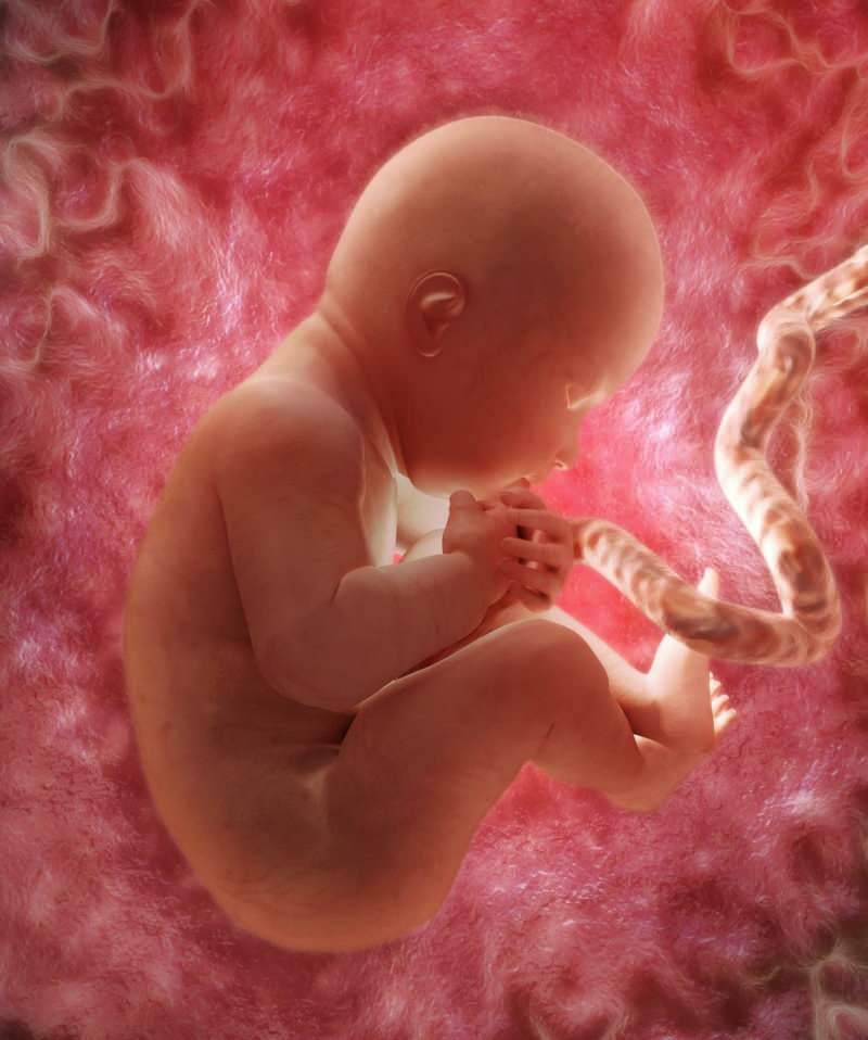 Verursacht Anämie in der Schwangerschaft?