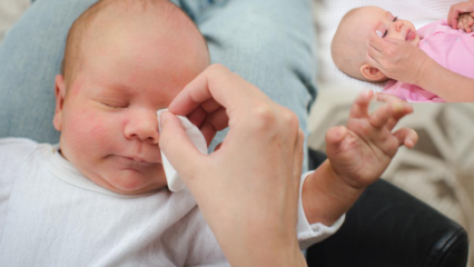 Wie Grate bei Babys entfernen? Verursacht bei Babys Augengrate? Gratmassage mit Muttermilch