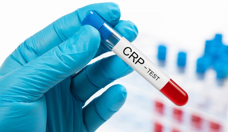 Warum steigt CRP im Blut? Was ist CRP? Wie kann man den CRP senken?
