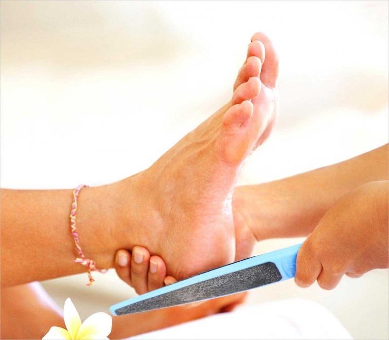 Der kritischste Punkt bei der Behandlung des Fußpilzes ist die Vermeidung häufiger Anwendungen.