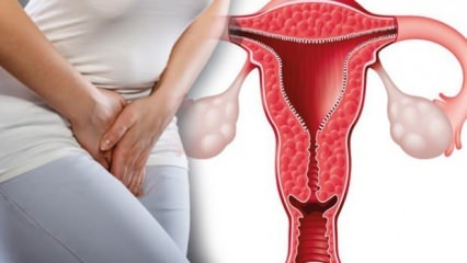 Was ist die Verdickung der Uteruswand? Wie groß sollte die Uteruswandstärke während der Schwangerschaft sein?