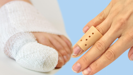 Was verursacht einen Fingerbruch? Was sind die Symptome eines Fingerbruchs?