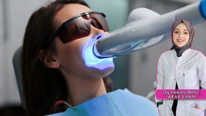 Wie wird die Methode der Zahnaufhellung (Bleaching) durchgeführt? Schadet die Bleichmethode den Zähnen?