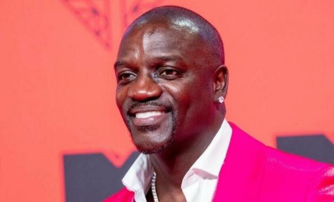 Der amerikanische Sänger Akon bevorzugte auch die Türkei für die Haartransplantation! Hier ist der Preis, den er bezahlt hat...