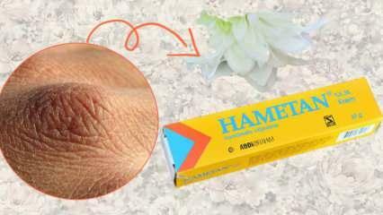 Was bewirkt Hametan-Creme? Hametan-Creme für den Heimgebrauch! Hametanische Unterschiede