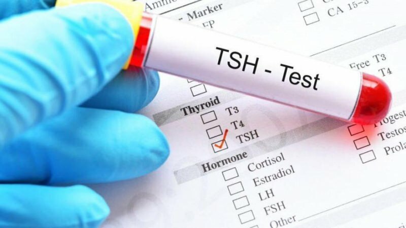 Der TSH-Test ist ein Hormontest