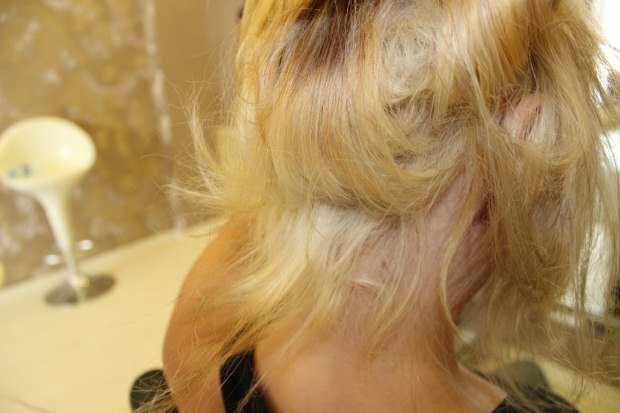 Was wird mit den brennenden Haaren aus der Mitte gemacht? Wie soll das behandelte Haar gepflegt werden?
