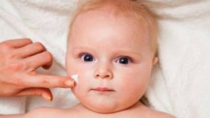 Hautpflegetipps für Babys! Was sind die Hautprobleme bei Babys?