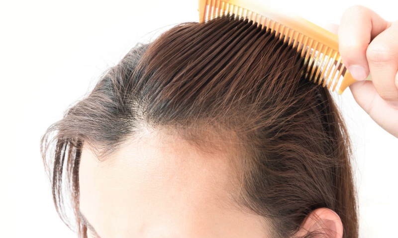 Haarausfalllösungen nach der Geburt! Was ist gut gegen Haarausfall?