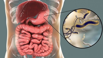 Was ist Helicobacter Pylori (Magenmikrobe)? Durch Helicobacter Pylori verursachte Krankheiten ...