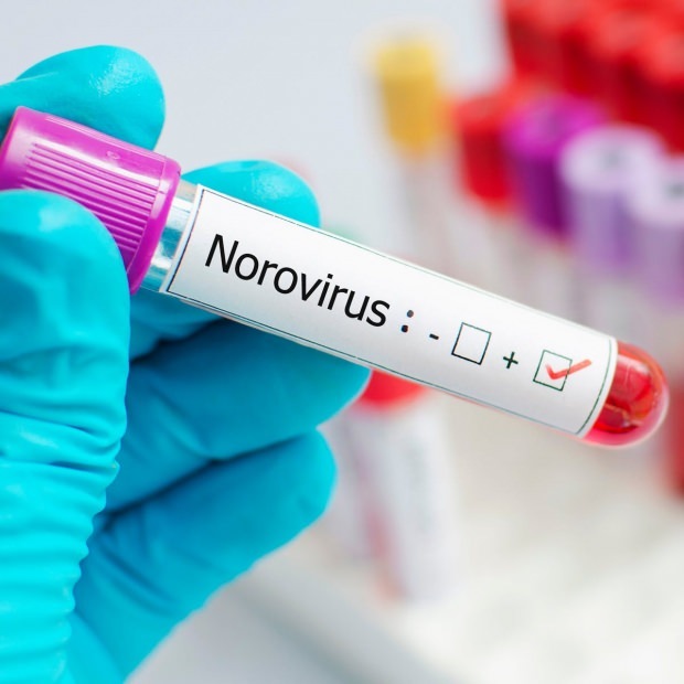 Was ist Norovirus und welche Krankheiten verursachen