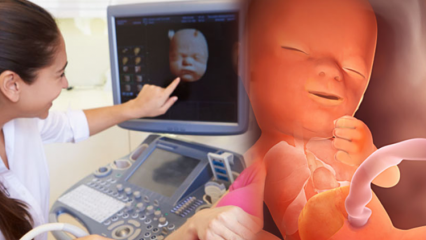 Welches Organ entwickelt sich zuerst bei Säuglingen? Babyentwicklung Woche für Woche