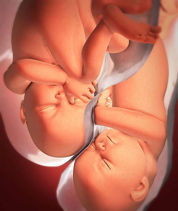 Was sind die Symptome einer Zwillingsschwangerschaft?