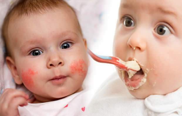 Allergiesymptome bei Säuglingen