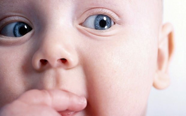 Warum verschiebt sich das Auge bei Babys?