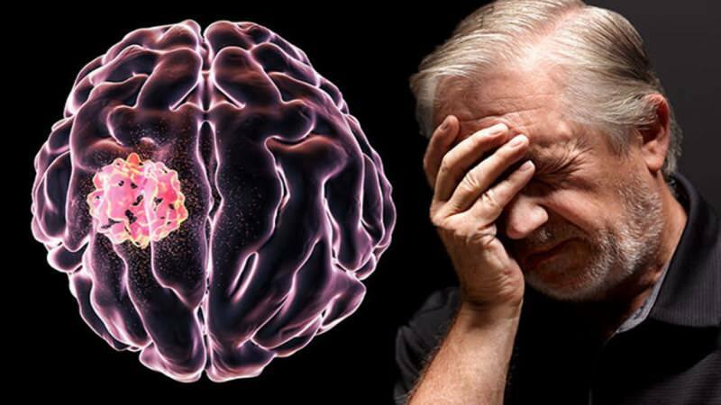 Das durch die Zerstörung der Zellstrukturen im Gehirn gebildete Gewebe wird als Tumor bezeichnet.