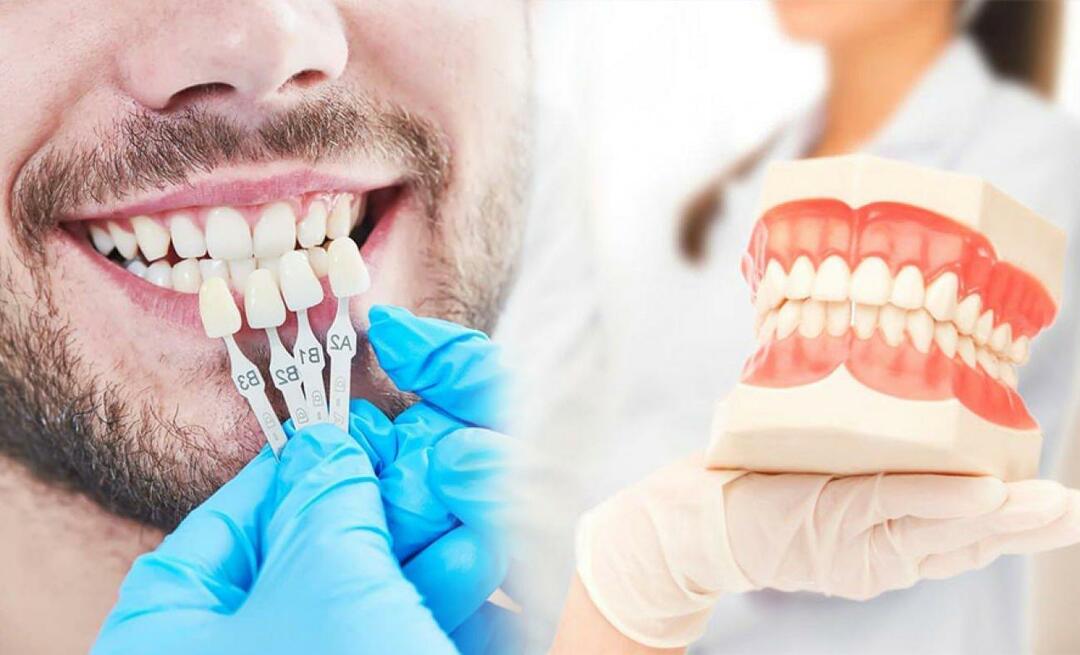 Warum wird Zirkonium-Veneer auf die Zähne aufgetragen? Wie haltbar ist die Zirkonbeschichtung?