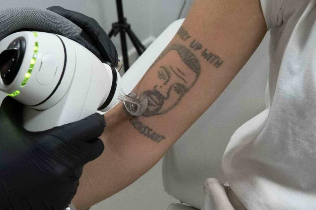 Riesiger Service für diejenigen, die Kanye West nicht mögen! Die Möglichkeit, sein Tattoo kostenlos entfernen zu lassen, hat für Chaos gesorgt