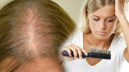 Was ist die effektivste Methode gegen Haarausfall? Maskenrezepte, die Haarausfall stoppen
